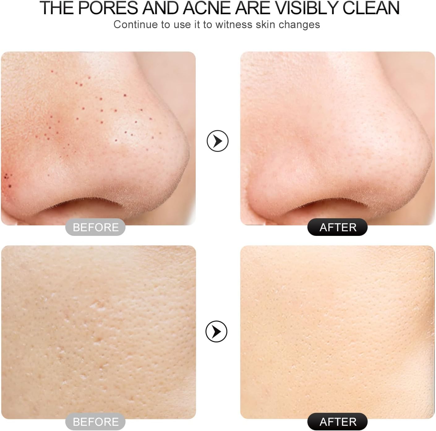 Face Scrubber Skin Spatula - Blackhead Remover with 4 Modes, Pore Extractor Face Spatula Deep Cleansing for Facial Skincare Women Gift