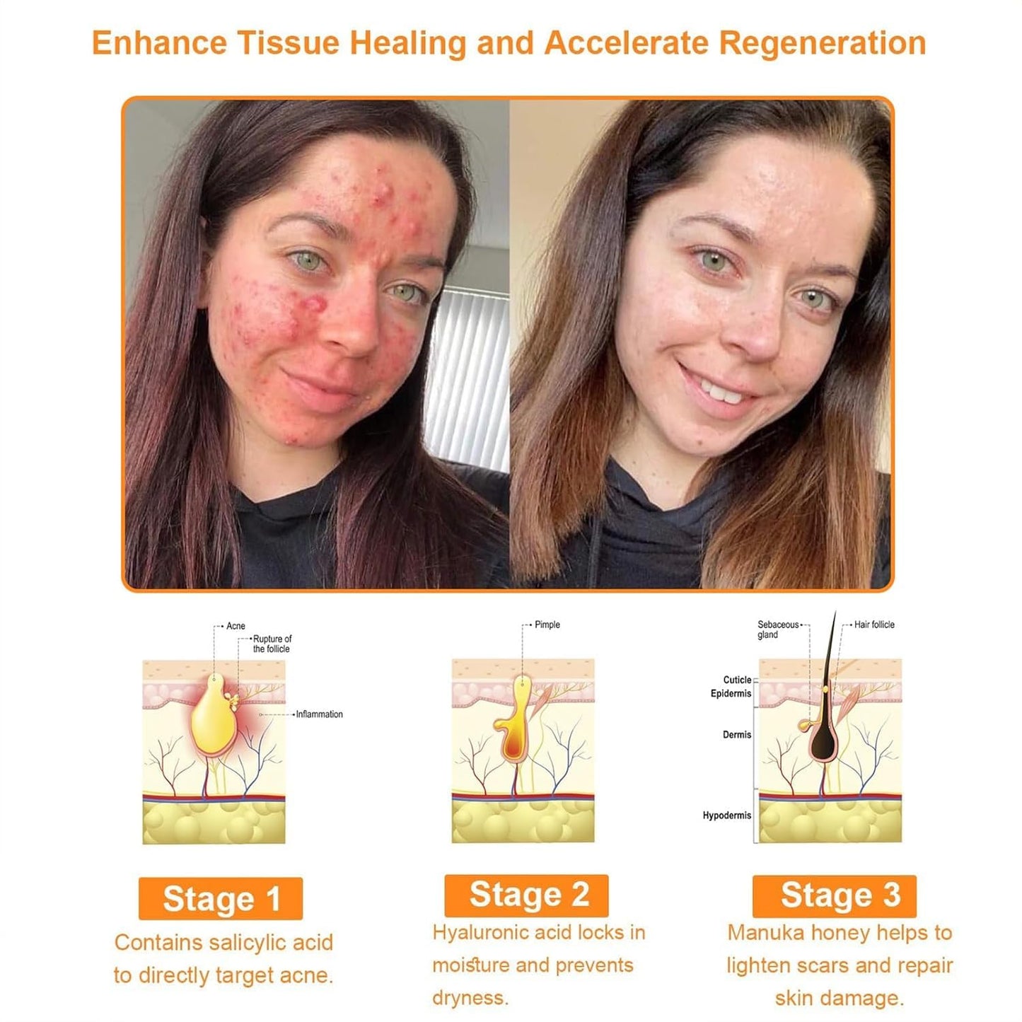 Bee Venom Comprehensive Bee Cream,2025 Professional Treatment Cream Wrinkle Removal Anti-Aging Moisturizing,Effective In Reducing Skin Blemishes (2PCS)