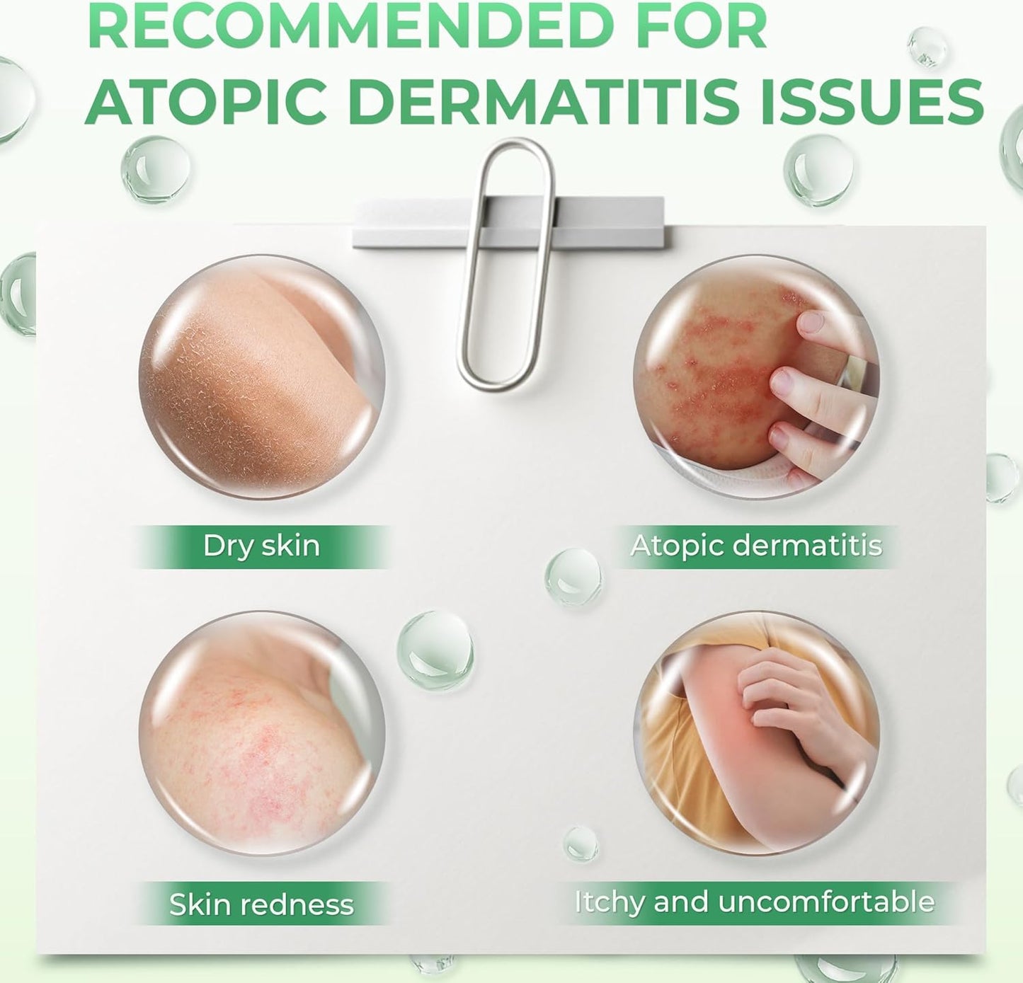 Atoskin Shower Gel for Eczema, Psoriasis, Dermatitis, and Anti-Itch Relief with RicoBio JA7 - for Atopic Dermatitis Patents (6.8 oz)