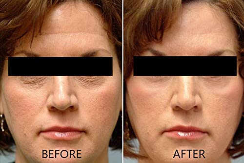 Vitamin C Serum 20% Pure L-Ascorbic Acid, Ferulic Acid, Vitamin E and HA and Hyaluronic Acid Serum with Vitamin B5 for Face and Eyes Natural Anti Aging Anti Wrinkle Set of 2 by Dr. Brenner