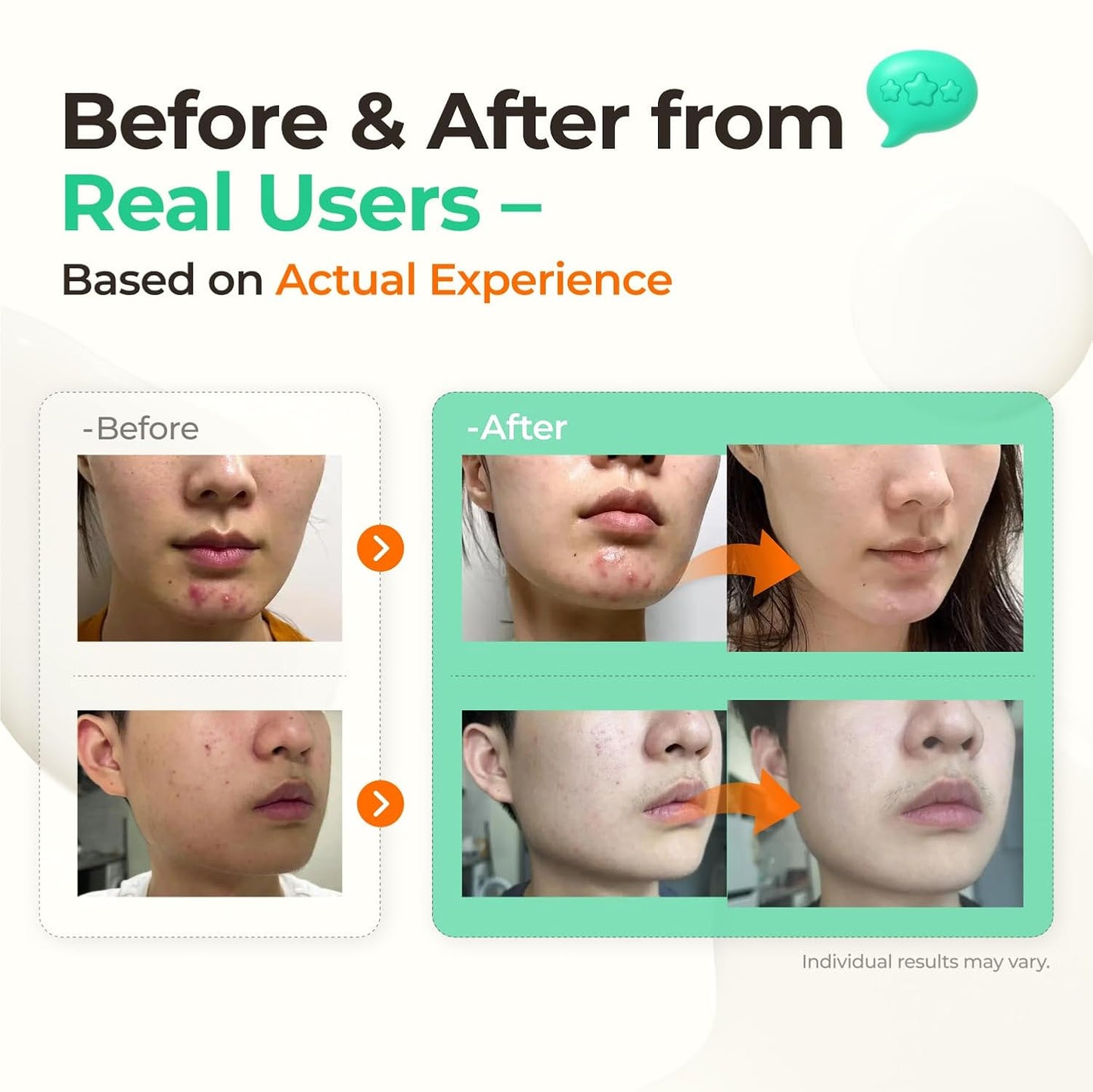 Watery Sulfur 82 Soothing Serum – Gentle Daily Face Serum for Acne-Prone & Sensitive Skin with 82% Sulfur Hot Spring Water, Fragrance-Free Formula | Korean Skincare (1.69 fl.oz / 50ml)