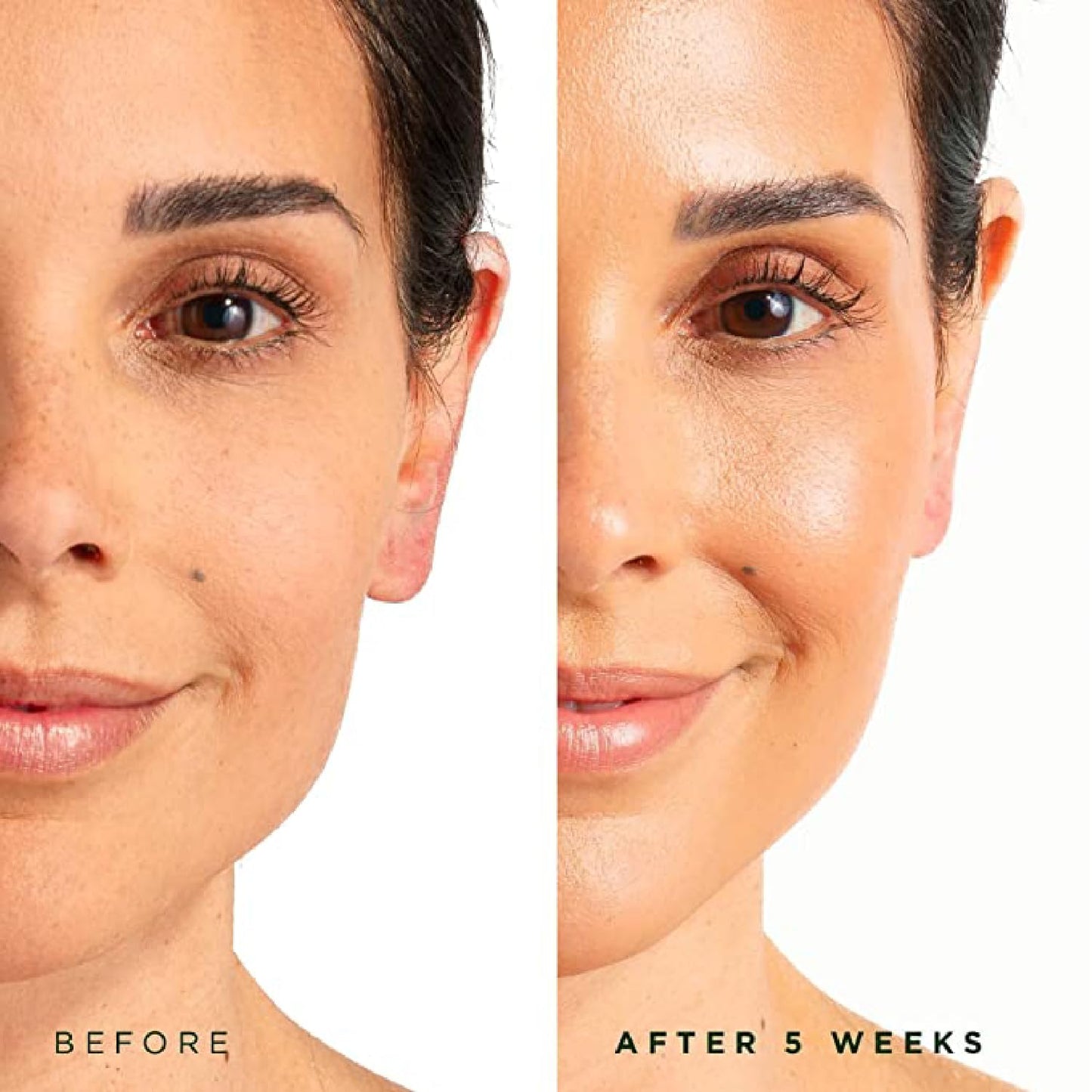 Tree of Life Beauty Hydrating Facial Serum - Pro Collagen Peptides with Argireline & Replexium - Anti Aging & Wrinkle Reduction - Dermatologist-Tested - 1 Fl Oz