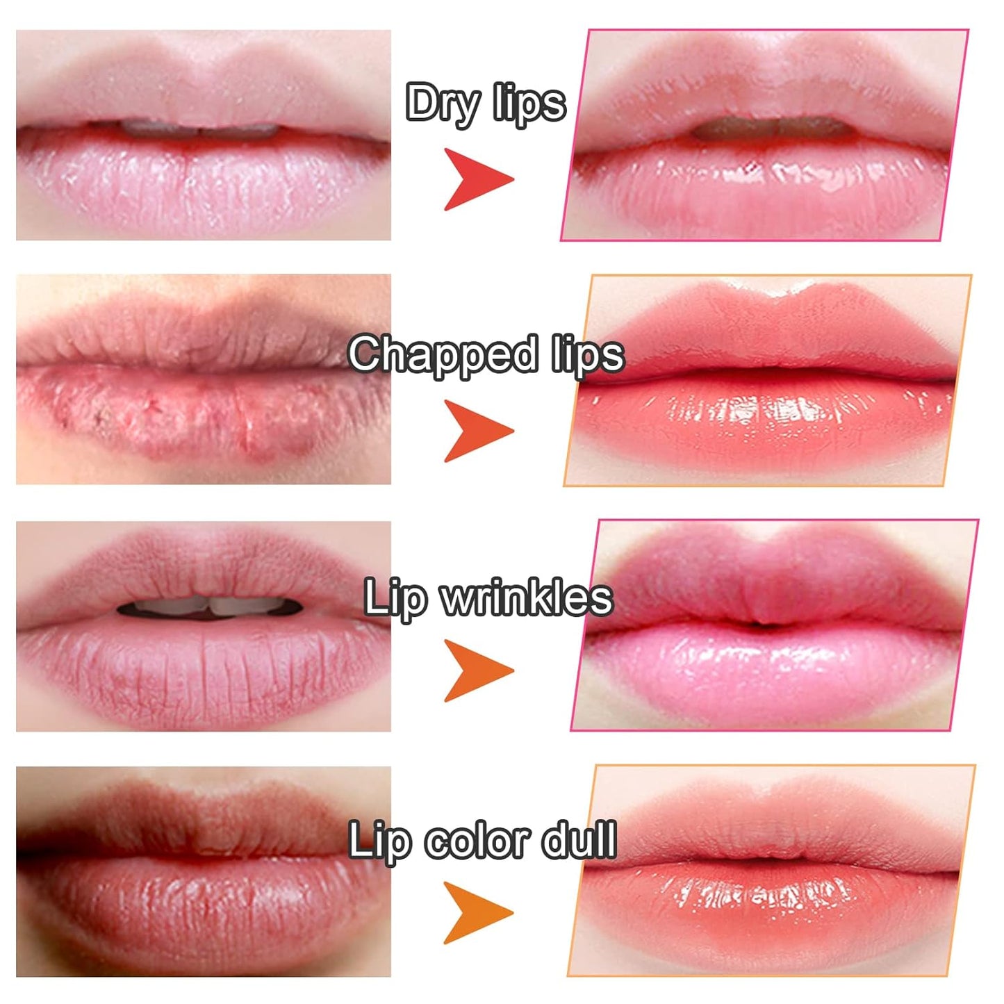 Adofect 30 Pieces Collagen Crystal Lip Masks, Collagen Lip Pads Great for Moisturizing, Remove Dead Skin, Anti Chapped & Anti-Aging and Plump Your Lips, Watermelom Red