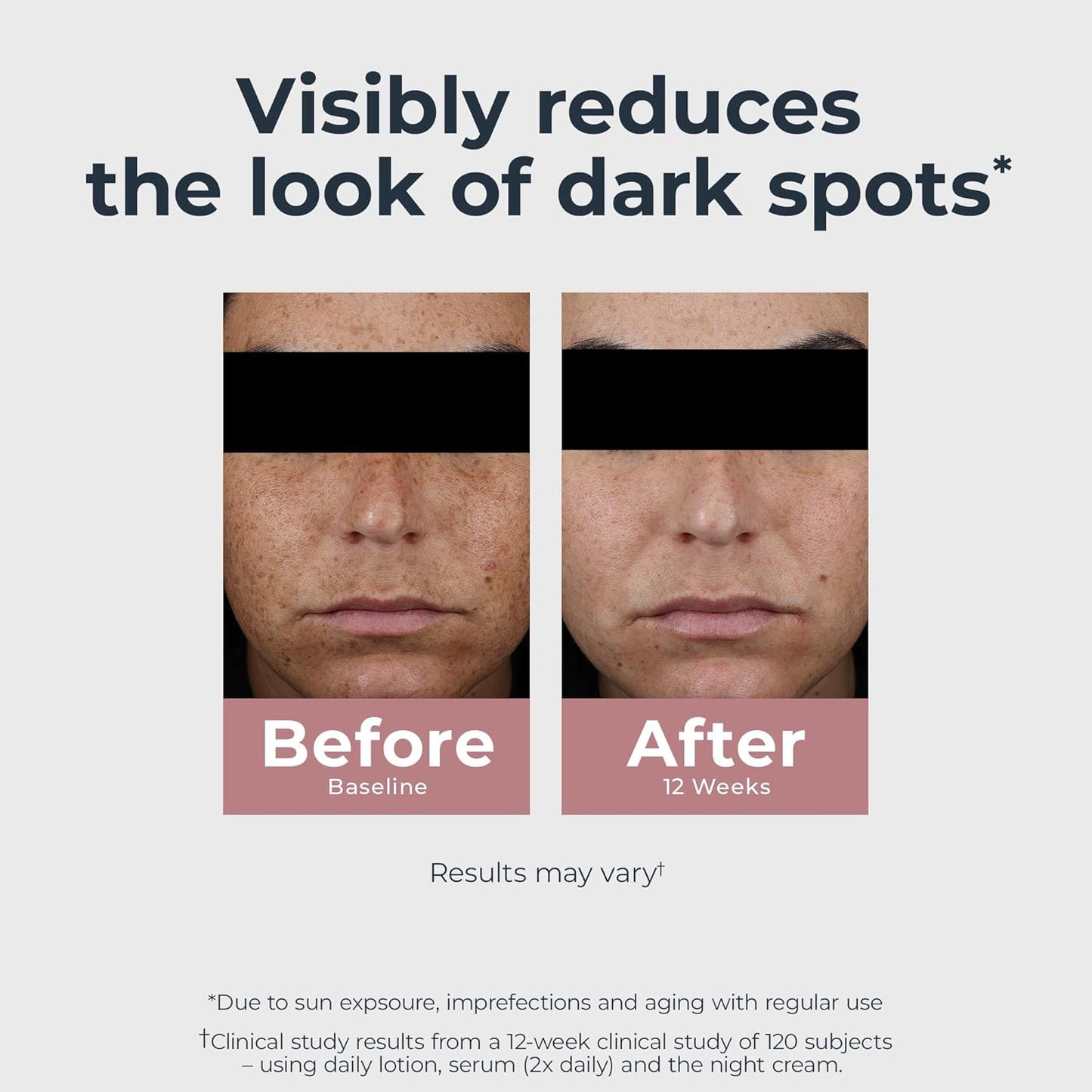 Eucerin Radiant Tone Daily Face Lotion with SPF 30, Dark Spot Corrector with Thiamidol, Face Moisturizer Helps Visibly Reduce the Look of Persistent Dark Spots, All Skin Types, 1.7 Fl Oz Bottle