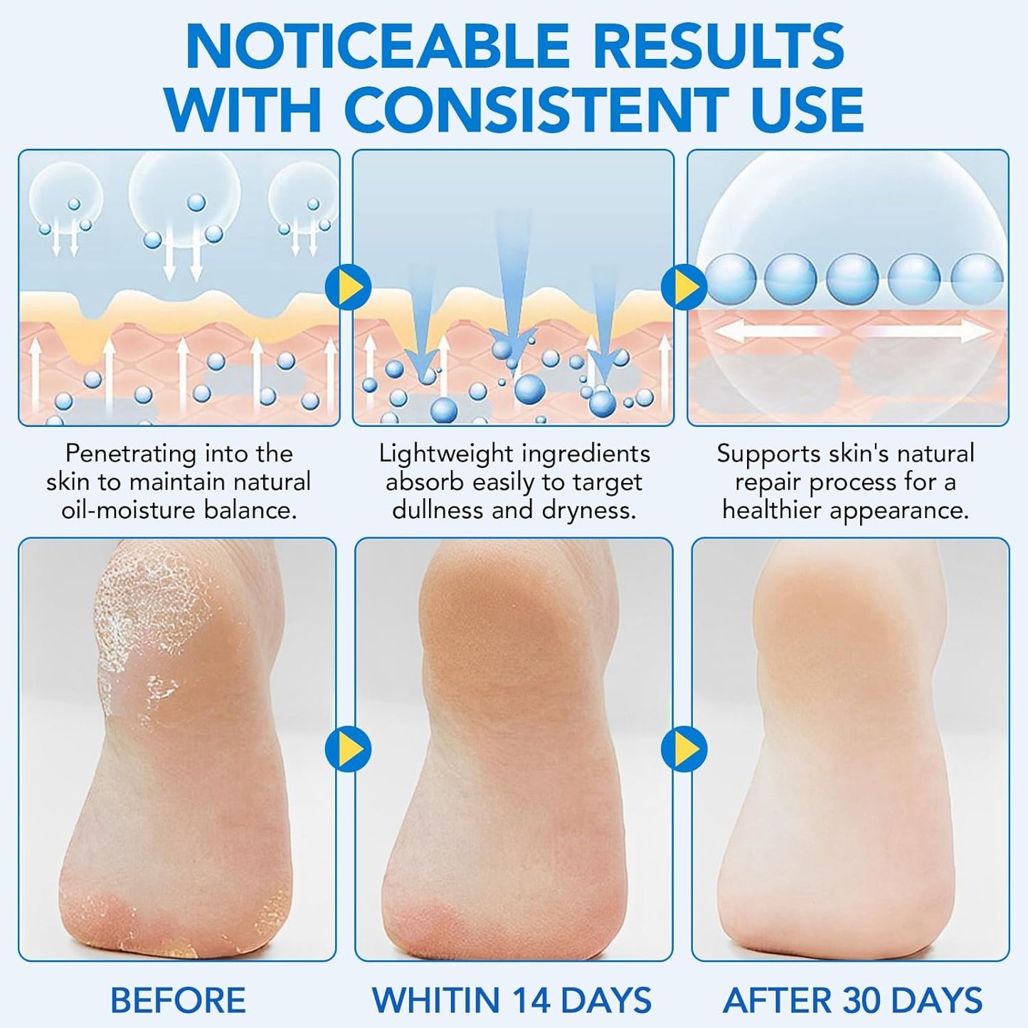 Urea Foot Care Stick, 60% Urea with 2% Salicylic Acid Foot Cream Moisturizer for Dry Cracked Feet, Knees, Elbows, Hands, Moisturizes and Hydrates the Dry Skin, Callus Remover & Skin Softener 1.41 oz