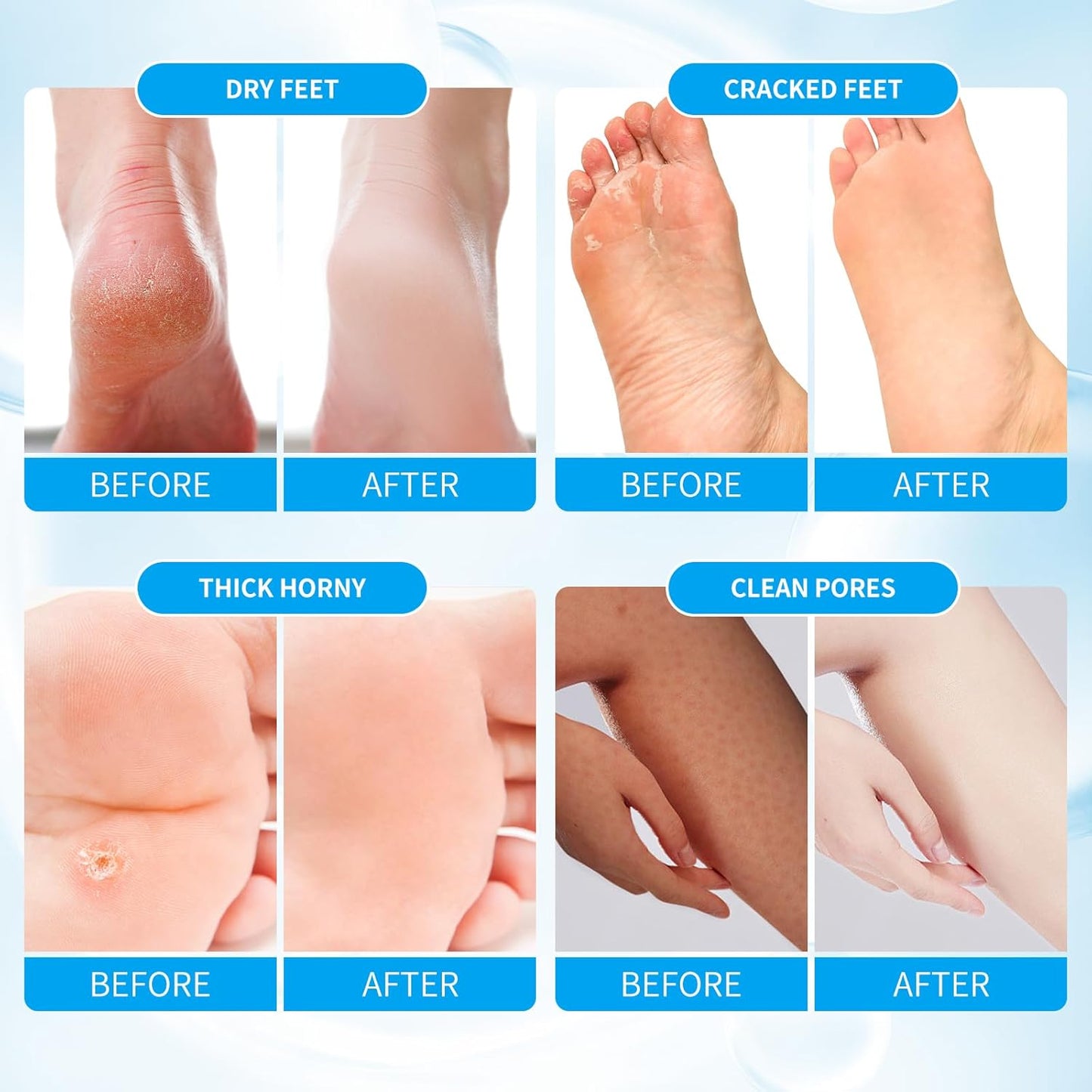 Pedicure Kit Foot Soak Set: Bubble Salt, Sugar Scrub, Massage Mask, Massage Lotion in a Box, 4 Step Foot Spa Kit for Dry Feet, Softens Calluses(1 Set Pacific Waves)