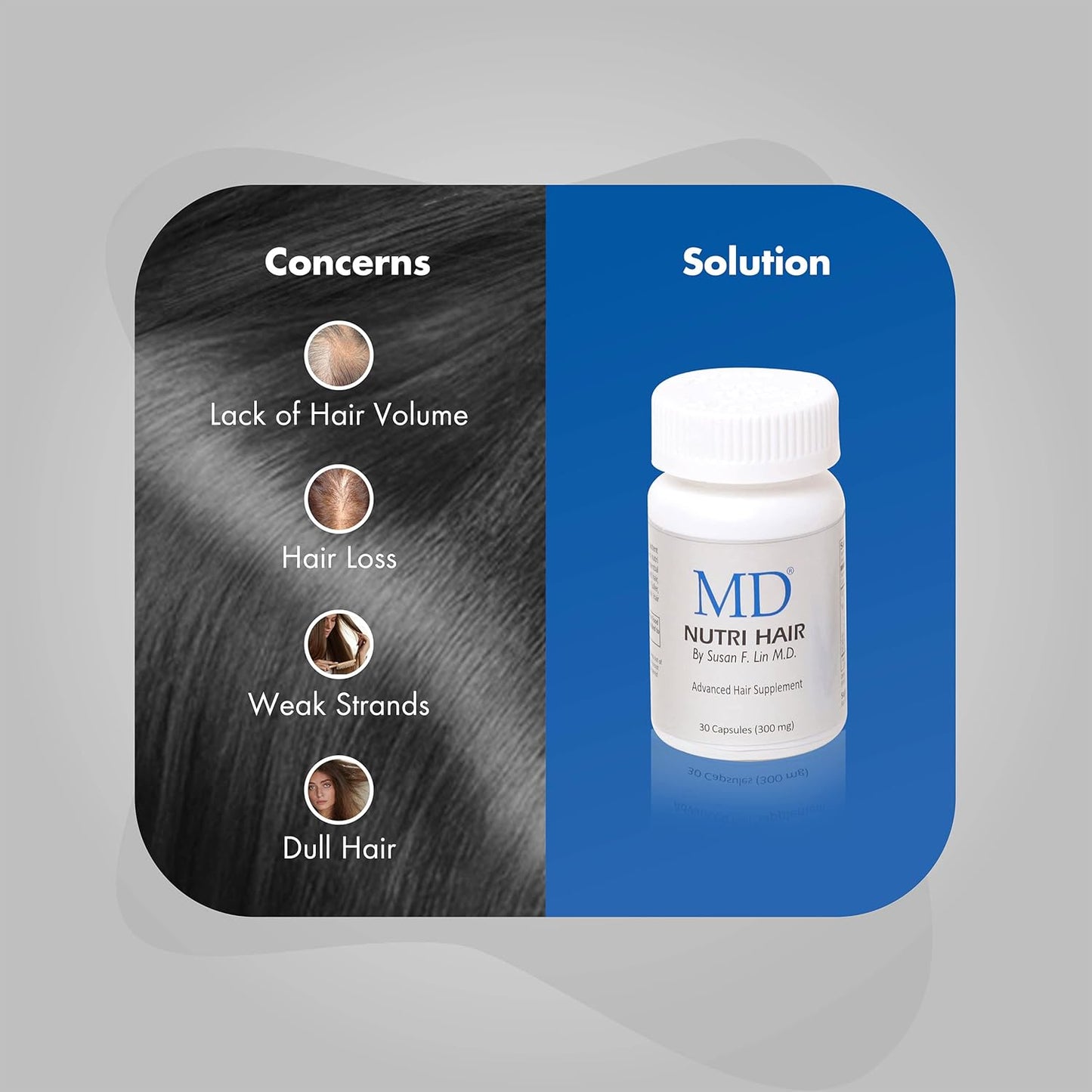 MD Nutri Hair Growth Supplement with Biotin (30 Capsules) | for Hair Loss, Minimizes Hair Shedding, Thinning, Breakage & Promotes Longer, Thicker Hair