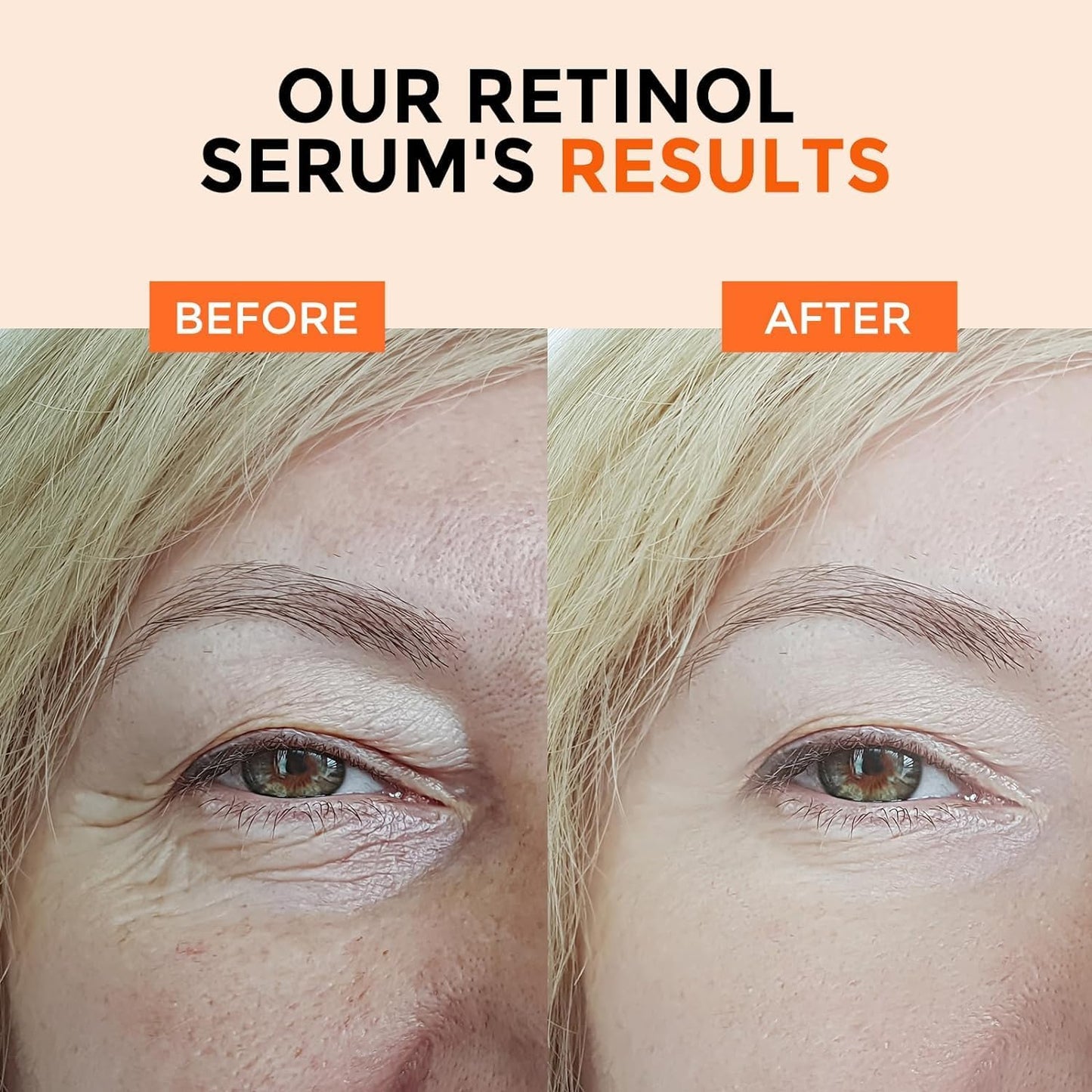 Retinol Serum for Face 2.5%, B5 Herbal Resurfacing Retinol with Vitamin C, Vitamin E, Hyaluronic Acid, Anti-Aging, Wrinkle Smoothing, Dark Spot Corrector, Brighten Dullness 2 Packs