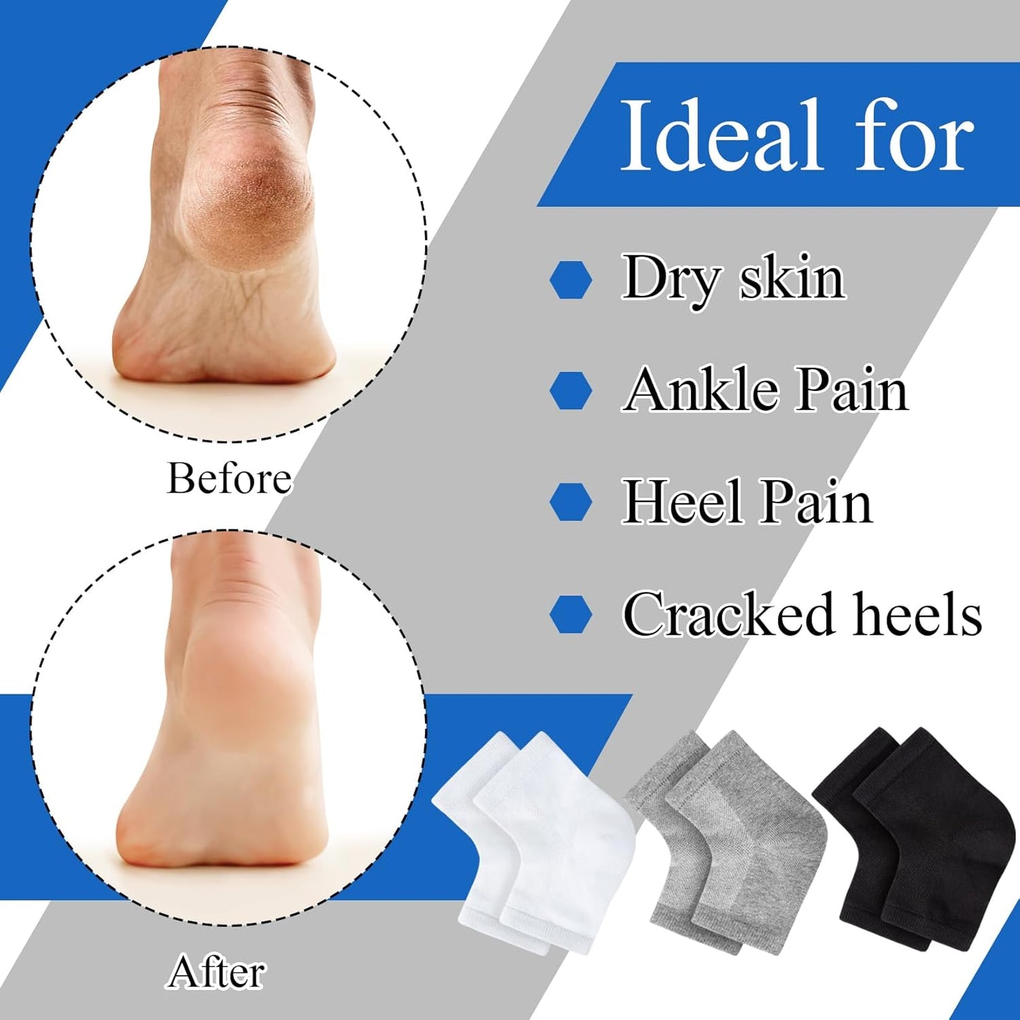 Moisturizing Socks,toeless Socks for Women for Dry Cracked Heel Treatment,Cracked Heel,msilicone Socks for Women (One Size-3 Pairs)