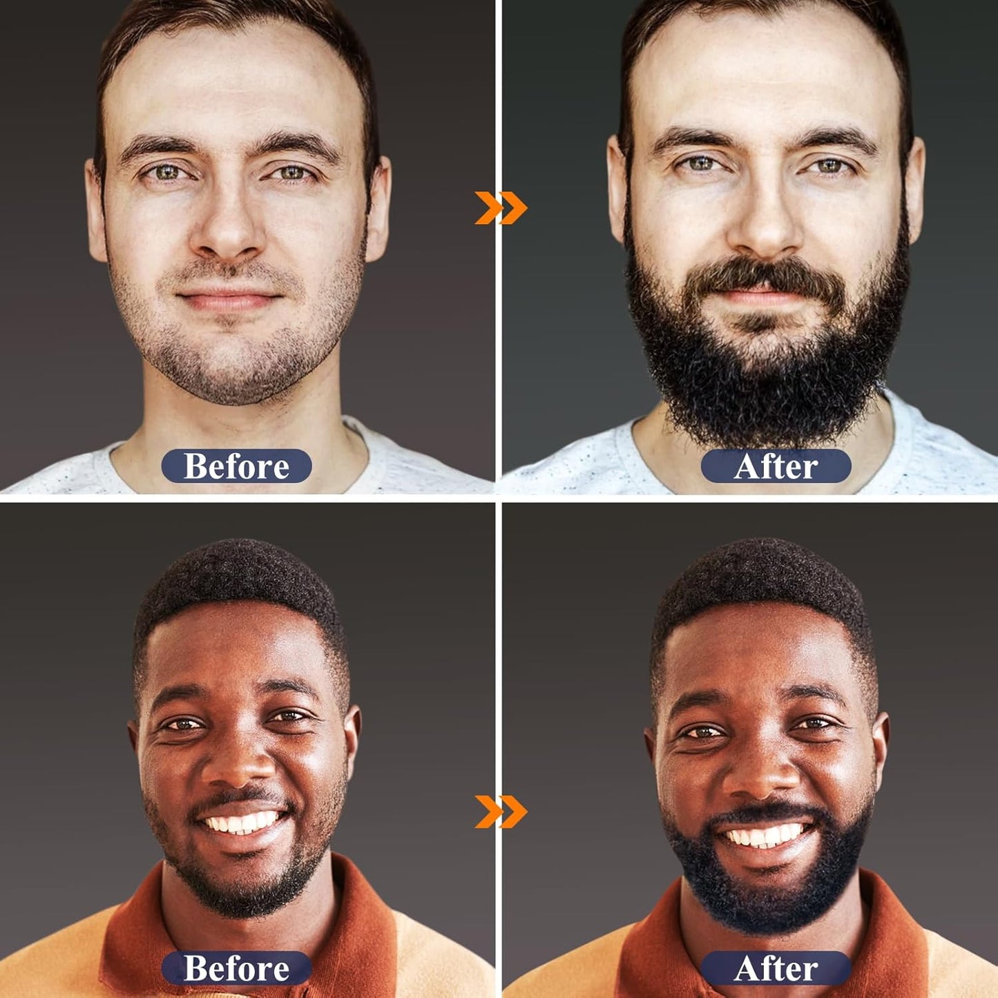 MALE GOD Beard Growth Kit, Beard Kit W/Beard Growth Oil (2 Bottles), Beard Balm, Beard Comb, Massager for Spot/Patchy Beard, Christmas Gifts for Men Him Boyfriend Husband