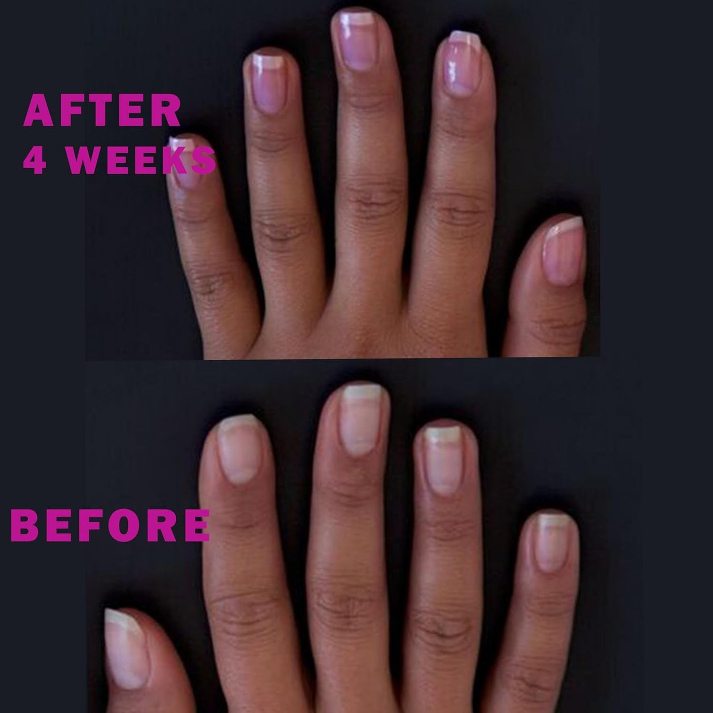 Perfect Formula Ruby Pink Gel Coat - Nail Strengthener, Keratin Nail Treatment, Gemstone Pink Gel Nail Polish - Nail Strengthener for Damaged Nails - Made In The USA .60 fl oz.