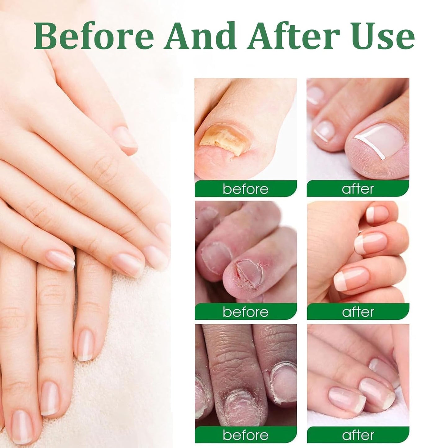 Nutraboost Nail Treatment Gel, Nail Growth Serum for Repair & Strengthener, Multi-Purpose Nail Repair Serum (3)