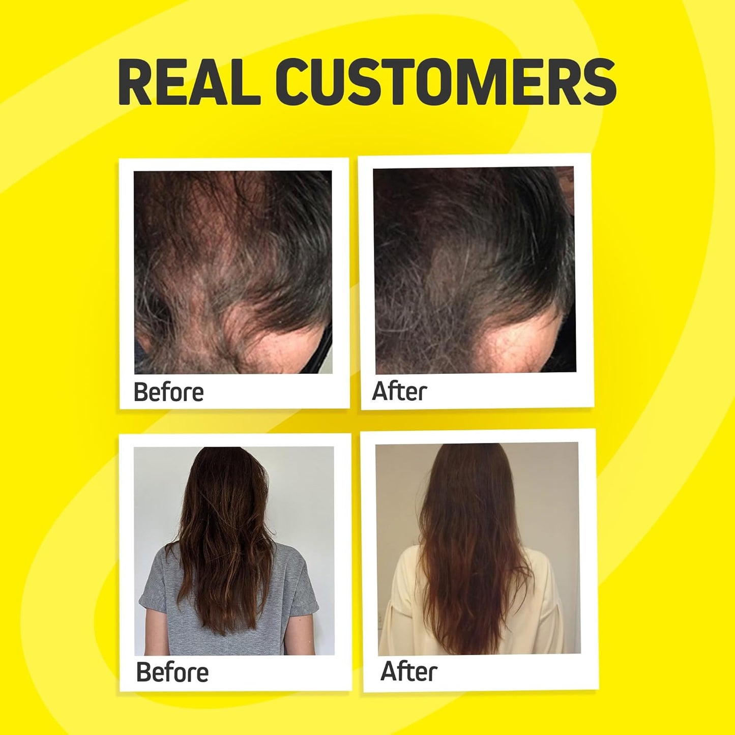 Hair Growth Vitamins for Women & Men | DHT Blocker with Saw Palmetto & 10000mcg Biotin, Foli Tonic Hair Growth Supplement – Supports Fuller, Thicker Hair Appearance, Non-GMO, 120 Vegan Capsules