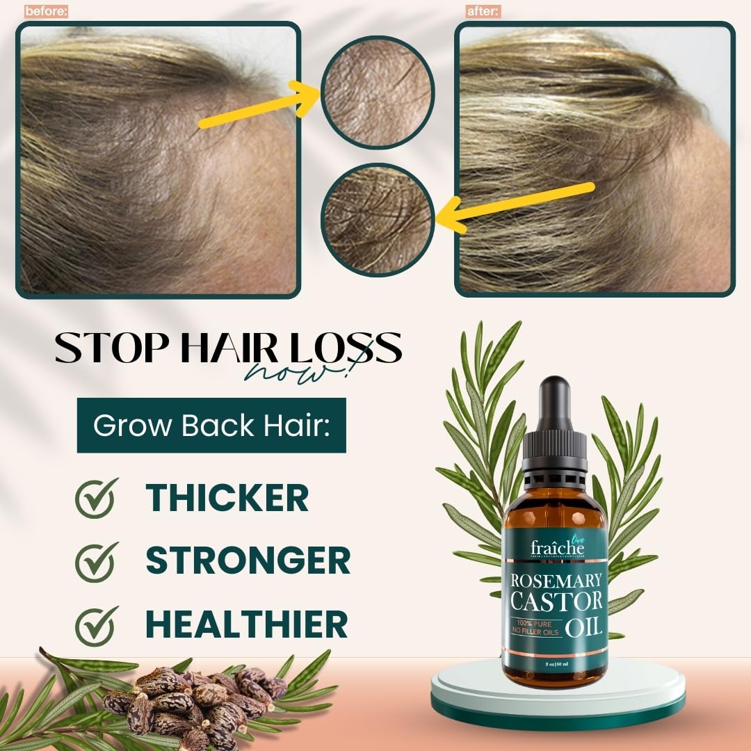 Live Fraiche Rosemary Oil for Hair Growth (2oz) with Cold Pressed Castor Oil Natural Hair Growth Oil - Rosemary and Castor Oil for Hair Growth -Strengthening Hair Oil for Damaged Hair and Hair Loss