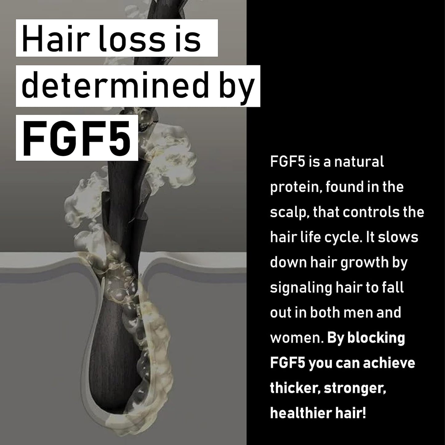 EVOLIS Promote Scalp Activator - Scalp Serum for Longer, Stronger Hair – Hair Repair Treatment – Hydrating Hair Growth Serum with Baobab & FGF5 Blockers (1.7 fl oz)