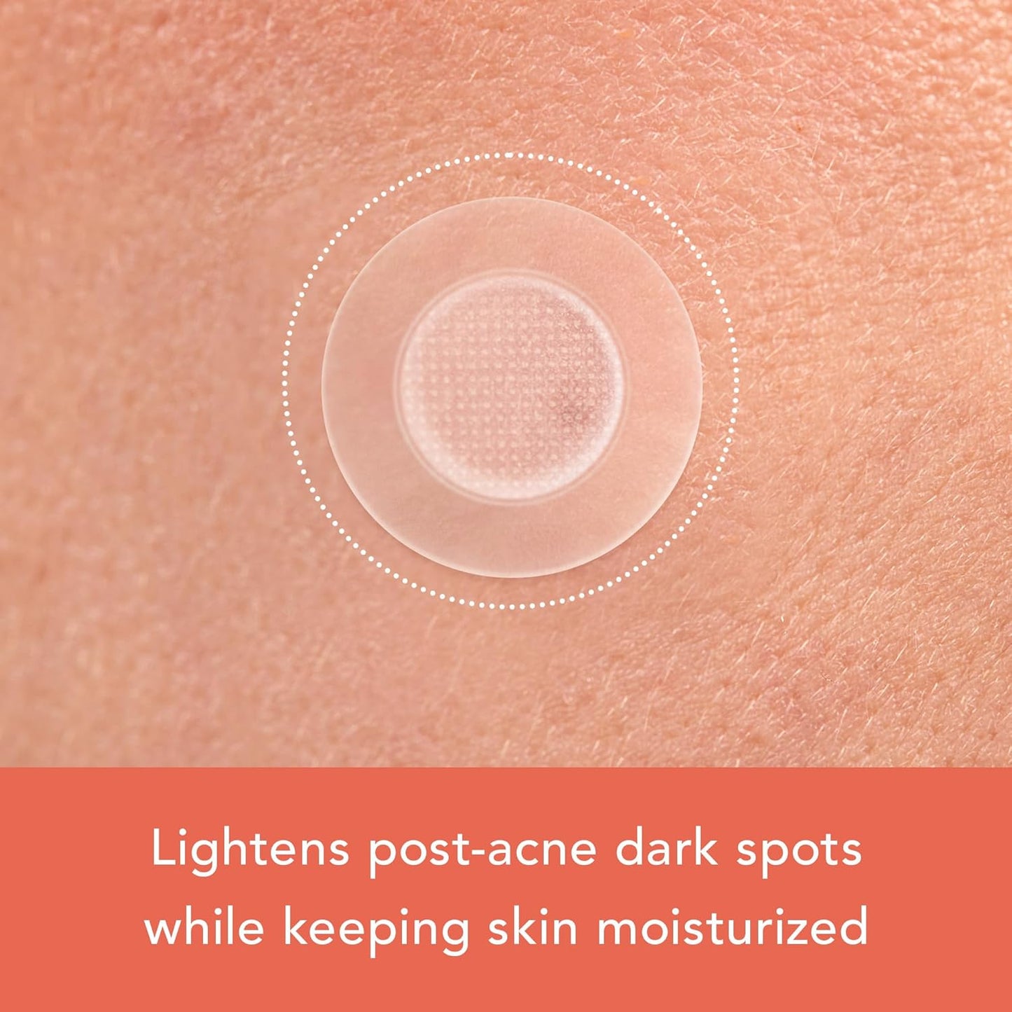 Rael Pimple Patches, Miracle Microcrystal Vitamin C Dark Spot Cover - Hydrocolloid Patch with Glutathione and Niacinamide, Treatment for Post Acne, Korean Skin Care, Vegan, Cruelty Free (9 Count)