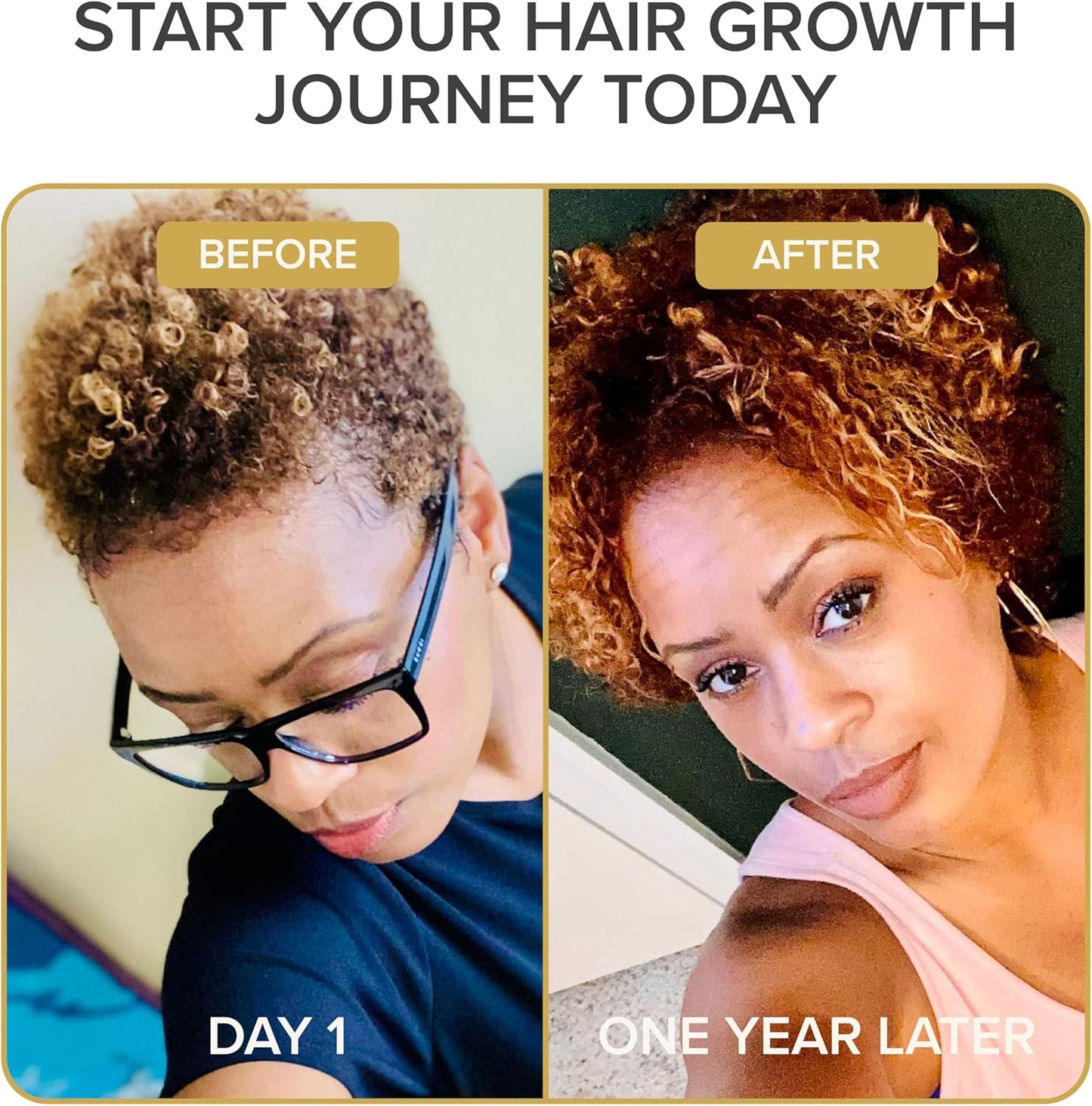 Iconic Natural Hair Vitamins for Fast Hair Growth, Pure Hair Supplements Formulated with Vitamins to Promote Thicker, Stronger Hair - Vegan Hair Care for Hair Loss - (60 Capsules(Pack of 1))