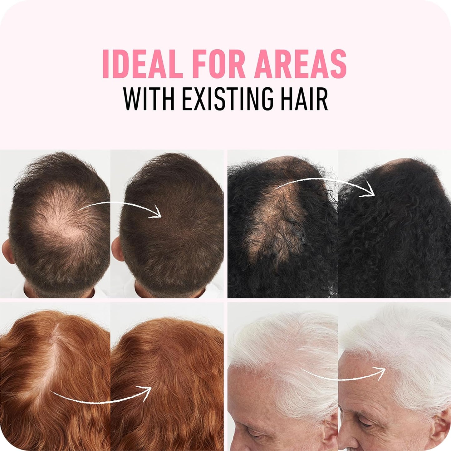 BOLDIFY Hair Fibers (28g) - Fill In Thinning and Fine Hair for an Instantly Fuller, Thicker Look - 14 Shades for Women & Men - Black