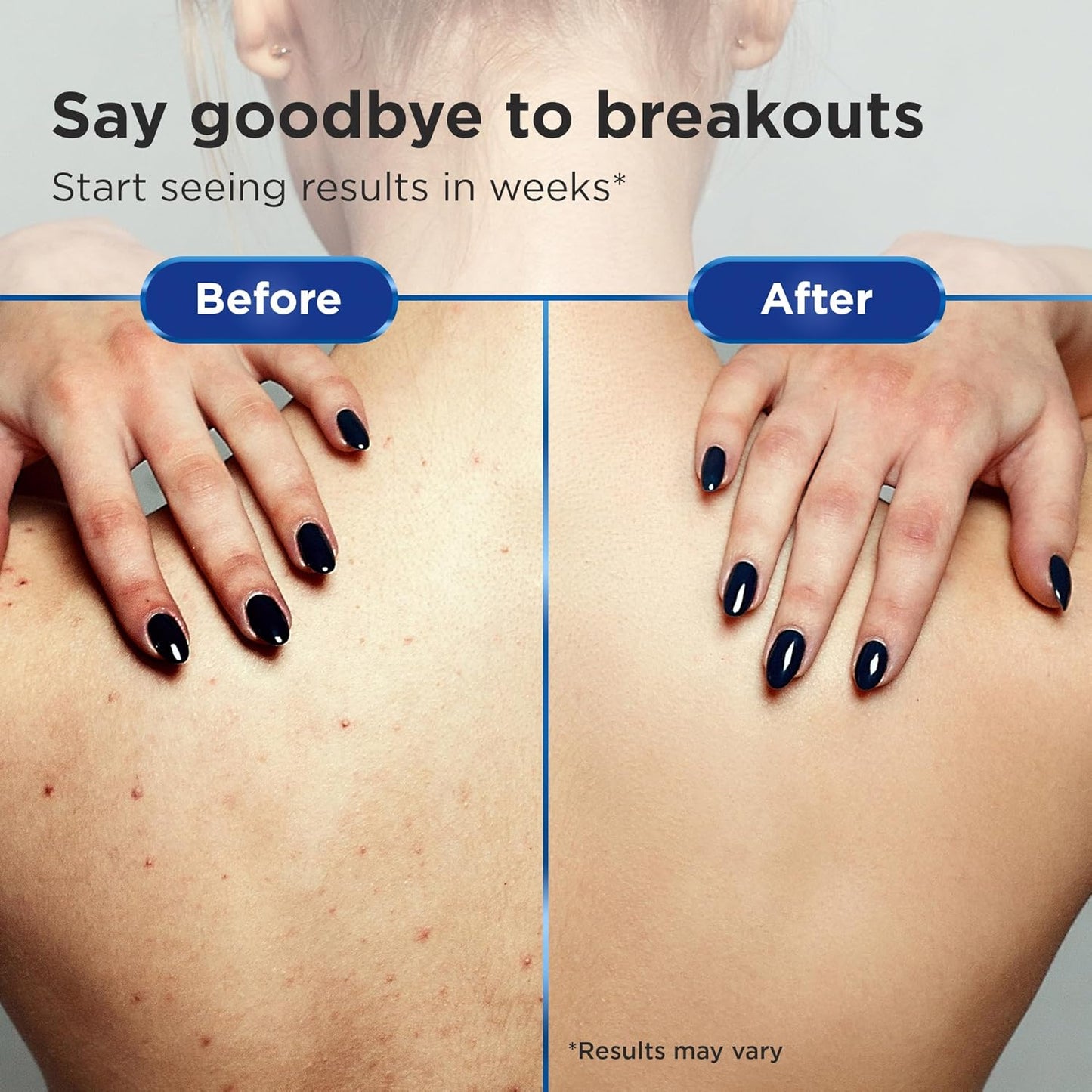 Non-Comedogenic Clear 2 Perfection Shampoo - Sulfate & Paraben-Free for Clear, Healthy Skin & Hair - Esthetician Formulated