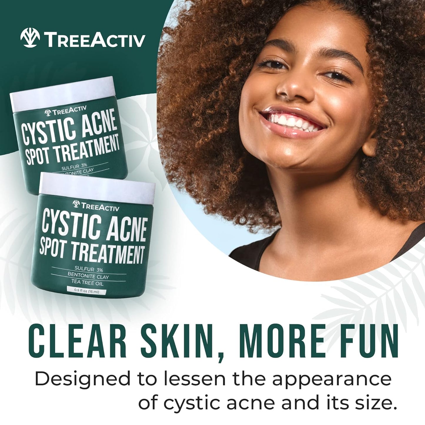 TreeActiv Cystic Acne Spot Treatment, Hormonal & Overnight Sulfur Cystic Treatment For Face, Pimples, and Blemishes for Adults, Men, and Women - 0.5oz 120+ Uses