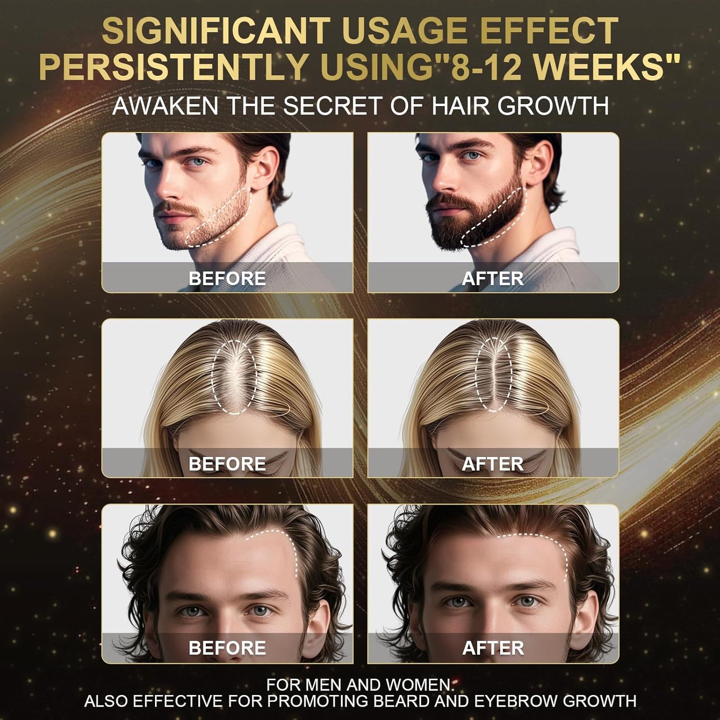 5% Minoxidil Foam for Men & Women - Hair Growth Treatment with Biotin, Non-Greasy Fast Absorbing Foam for Thinning Hair, Regrow Fuller Thicker Hair & Beard, 3 Month Supply (3 x 2.12 oz)