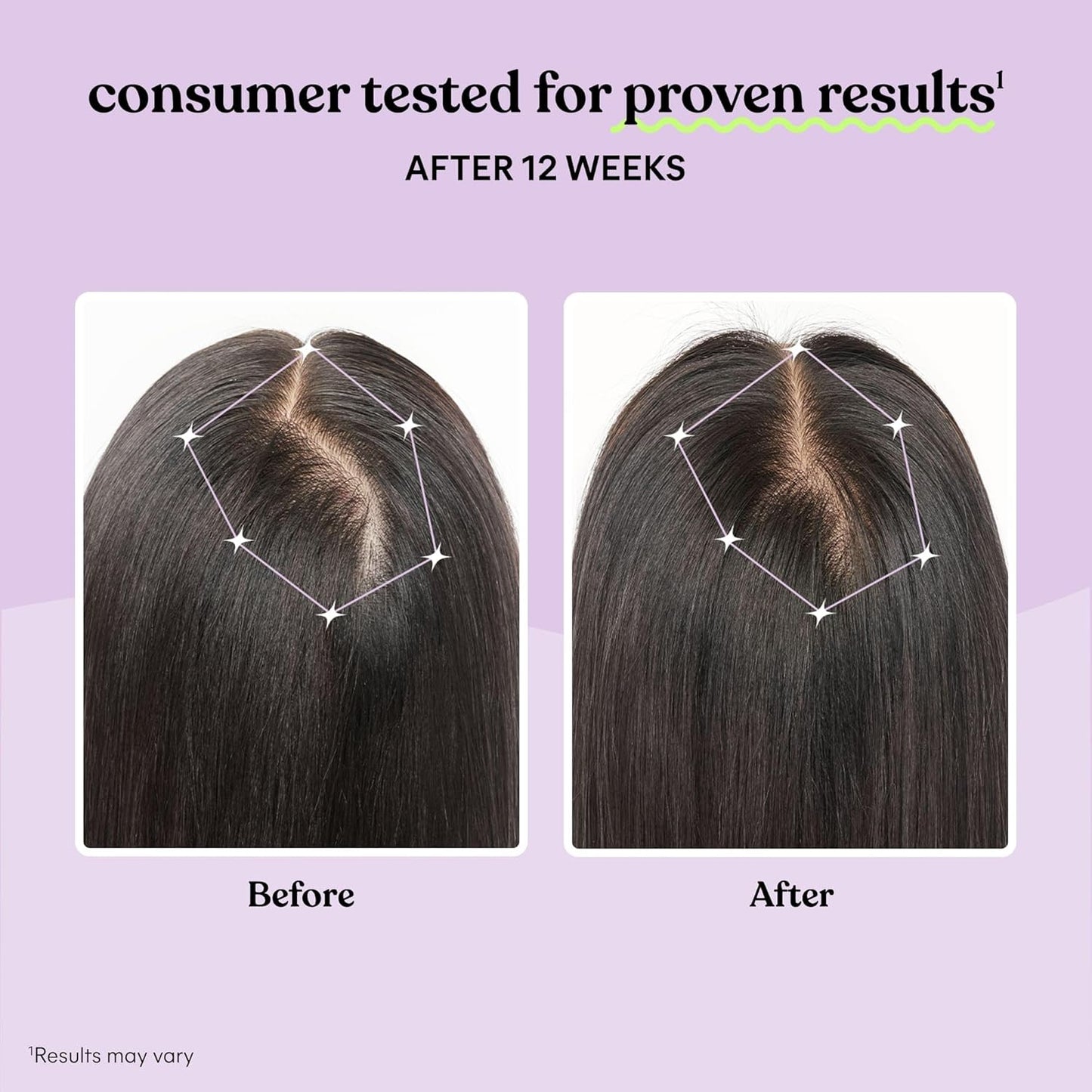 Lemme Grow Hair Growth Supplement for Women, Clinically Proven Keratin Complex for Visibly Thicker Hair and Scalp Coverage, Reduced Shedding, Nourish Thinning Hair - 1 Month Supply