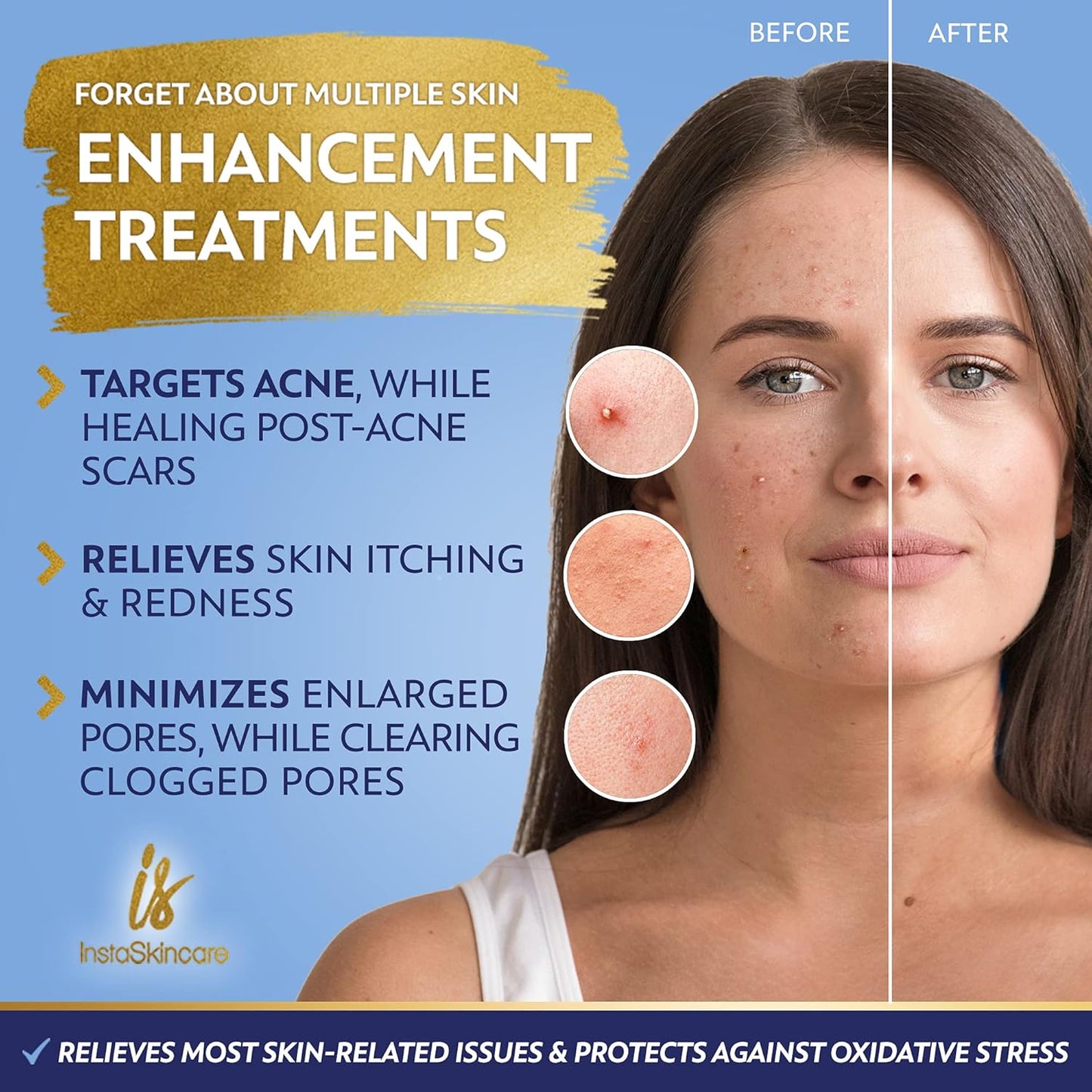 DOUBLE SIZED (2Oz) Niacinamide Serum for Face 10% with Zinc 1% Vitamin B3 Brightening Serum for for Tone, Texture and Hydrating