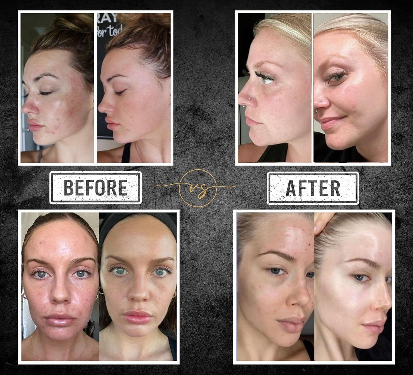 All-in-One Face & Body Unisex Bar - 40+ Ingredient Complex Vitamin C,E,B3 Retinol, Hyaluronic/Glycolic/Salicylic Acid - Kojic, Turmeric and B-Carotene for Cleansing and Beautifying Skin (10.6 oz)